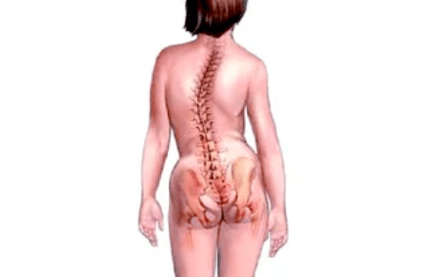 Las razones para el desarrollo de la osteocondosis cervical