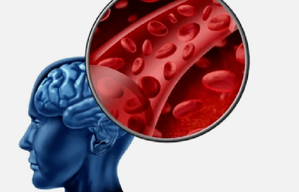 Síntomas de osteocondosis de la columna cervical