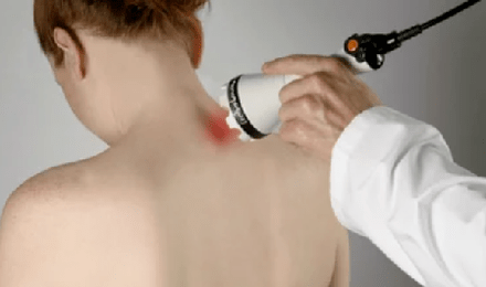 Tratamiento de la osteocondrosis cervical a través de la fisioterapia